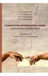 Радиология церебральных глиом: диагностика и мониторинг