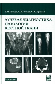 Лучевая диагностика патологии костной ткани. 2-е изд