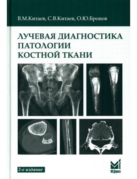 Лучевая диагностика патологии костной ткани. 2-е изд