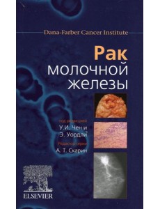 Рак молочной железы Рак молочной железы