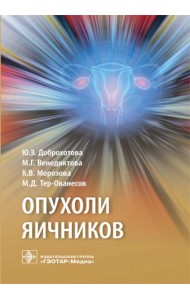 Опухоли яичников: руководство