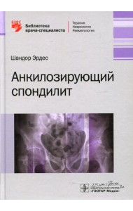 Анкилозирующий спондилит