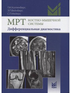 МРТ костно-мышечной системы. Дифференциальная диагностика