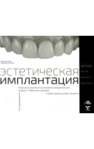 Эстетическая имплантация. Сложные клинические случаи работы во фронтальных отделах с глобальным подходом к реконструкции улыбки пациента