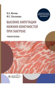 Высокие ампутации нижних конечностей при гангрене: Учебное пособие
