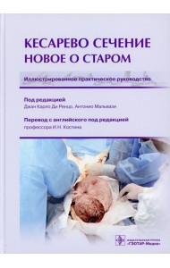 Кесарево сечение. Новое о старом. Иллюстрированное практическое руководство