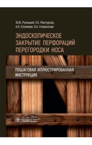 Эндоскопическое закрытие перфораций перегородки носа: пошаговая иллюстрированная инструкция