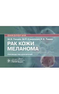 Рак кожи. Меланома: руководство для врачей