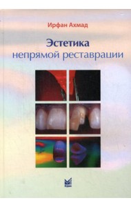Эстетика непрямой реставрации