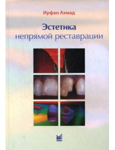 Эстетика непрямой реставрации Эстетика непрямой реставрации