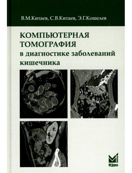 Компьютерная томография в диагностике заболеваний кишечника. 2-е изд