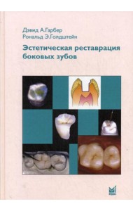 Эстетическая реставрация боковых зубов