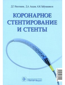 Коронарное стентирование и стенты