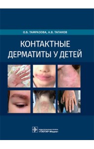 Контактные дерматиты у детей