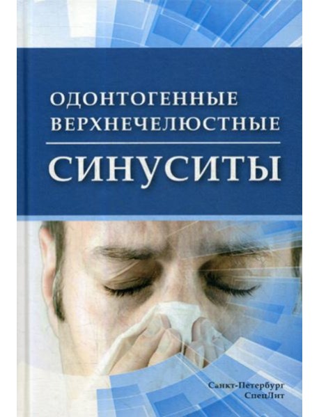 Одонтогенные верхнечелюстные синуситы