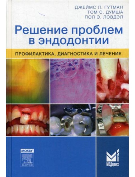 Решение проблем в эндодонтии. Профилактика, диагностика и лечение. 2-е изд