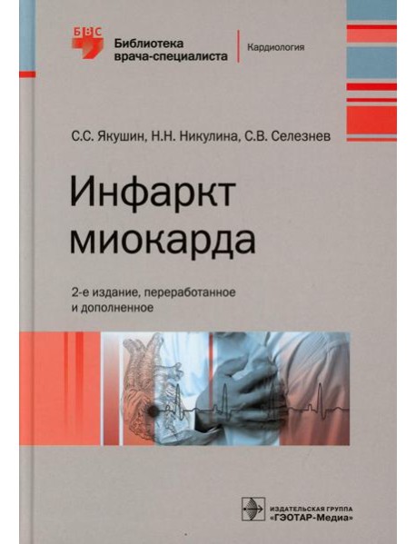 Инфаркт миокарда. 2-е изд., перераб. и доп