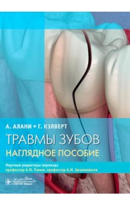 Травмы зубов. Наглядное пособие