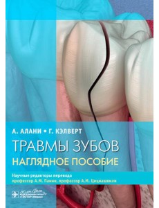 Травмы зубов. Наглядное пособие