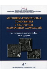 Магнитно-резонансная томография в диагностике эндокринных заболеваний