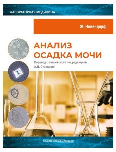 Анализ осадка мочи