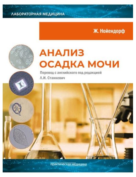 Анализ осадка мочи