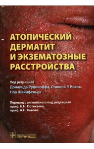 Атопический дерматит и экзематозные расстройства