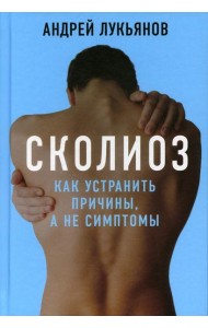 Сколиоз. Как устранить причины, а не симптомы