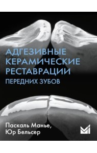 Адгезивные керамические реставрации передних зубов. 4-е изд