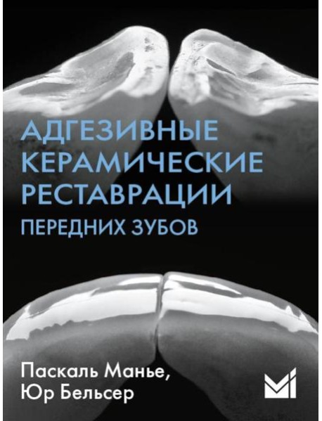 Адгезивные керамические реставрации передних зубов. 4-е изд