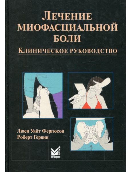 Лечение миофасциальной боли