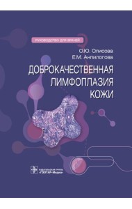 Доброкачественная лимфоплазия кожи: руководство для врачей