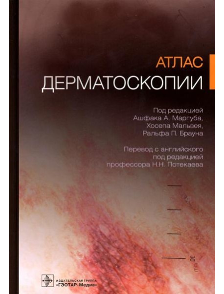 Атлас дерматоскопии