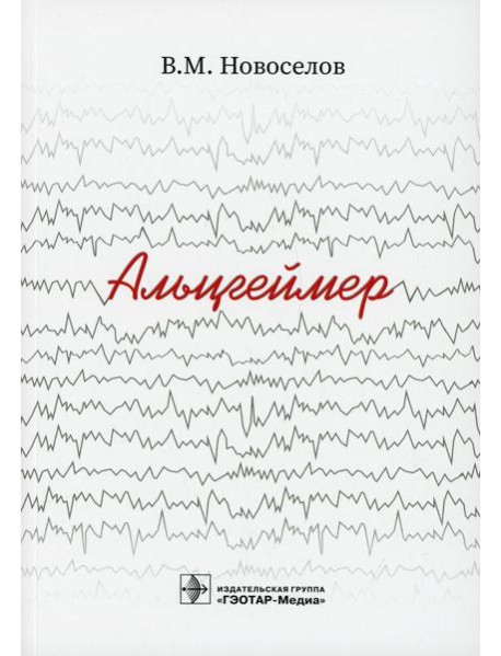 Альцгеймер