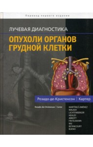 Лучевая диагностика. Опухоли органов грудной клетки