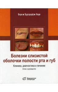 Болезни слизистой оболочки полости рта и губ. Клиника, диагностика и лечение. Атлас и руководство