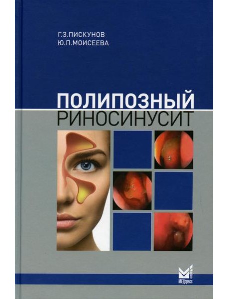 Полипозный риносинусит. 2-е изд., доп