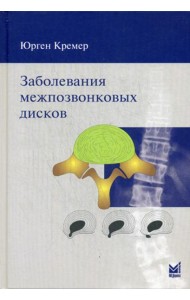 Заболевания межпозвонковых дисков. 2-е изд