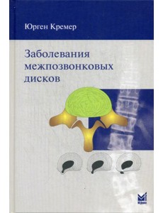 Заболевания межпозвонковых дисков. 2-е изд
