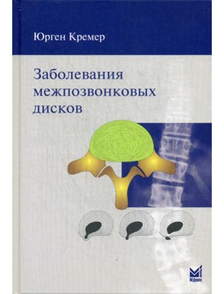 Заболевания межпозвонковых дисков. 2-е изд