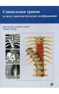 Спинальная травма в свете диагностических изображений