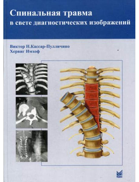 Спинальная травма в свете диагностических изображений