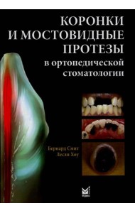 Коронки и мостовидные протезы в ортопедической стоматологии