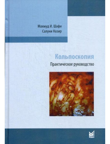 Кольпоскопия. Практическое руководство