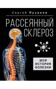Рассеянный склероз. Моя история болезни