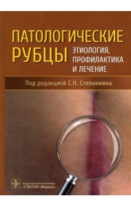 Патологические рубцы. Этиология, профилактика и лечение