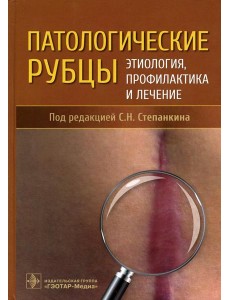 Патологические рубцы. Этиология, профилактика и лечение