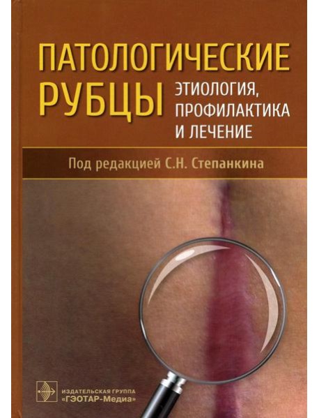 Патологические рубцы. Этиология, профилактика и лечение