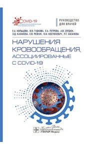 Нарушения кровообращения, ассоциированные с COVID-19: руководство для врачей