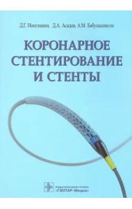 Коронарное стентирование и стенты